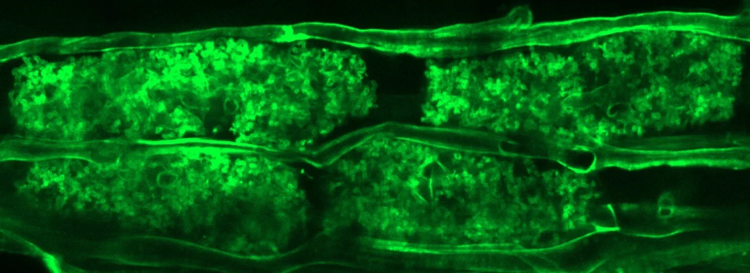 Arbuscular mycorrhizal structures